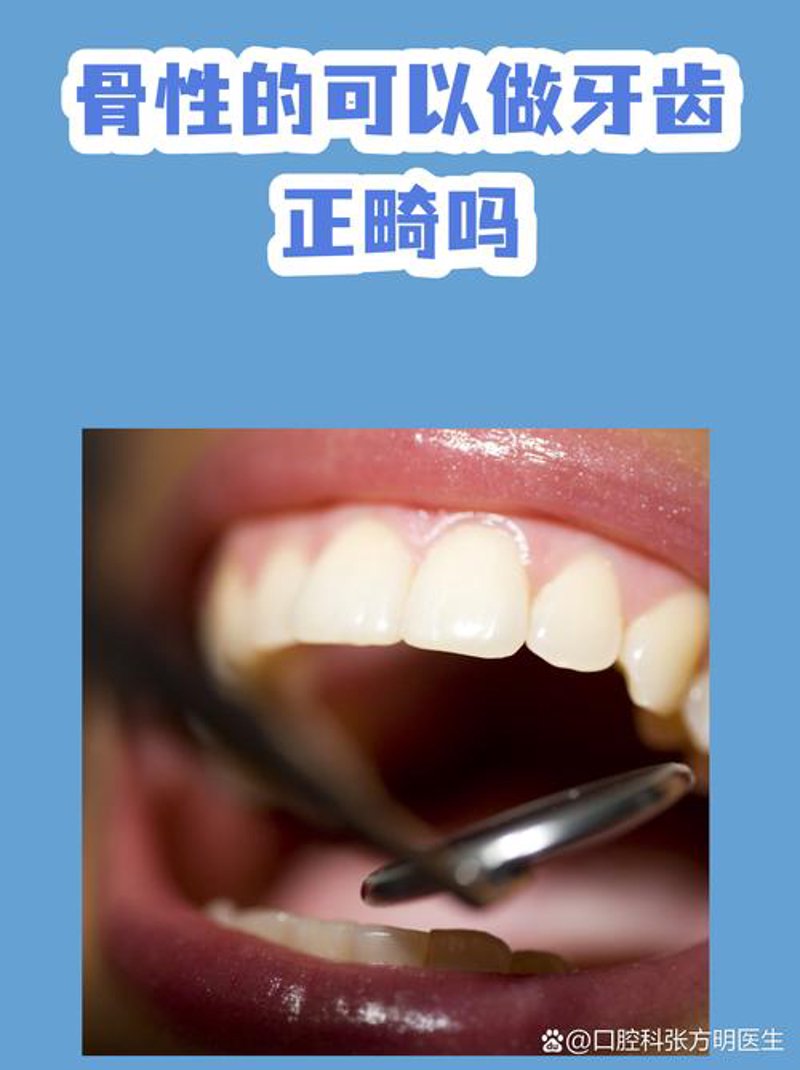 牙齿矫正：选择完美笑容的三大攻略